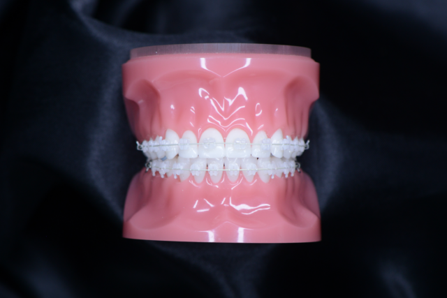 https://firstortho.co.uk/wp-content/uploads/2024/02/ceramic-big-640x427.png