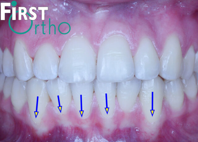 https://firstortho.co.uk/wp-content/uploads/2024/06/GH-49855-2-640x460.jpg